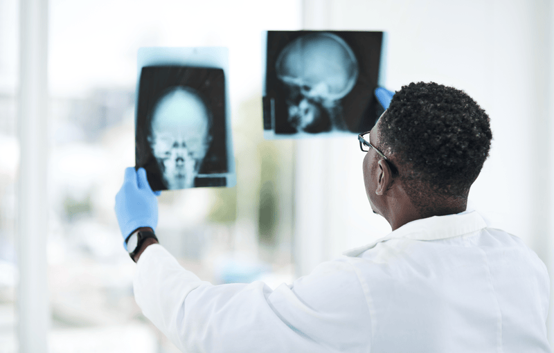 shot-of-a-young-doctor-analysing-an-x-ray-of-a-pat-2023-11-27-05-32-13-utc